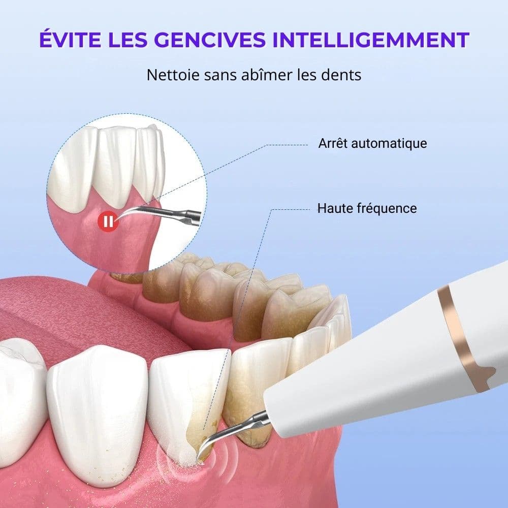 Détartreur dentaire à ultrasons USB – nettoyage des dents à domicile