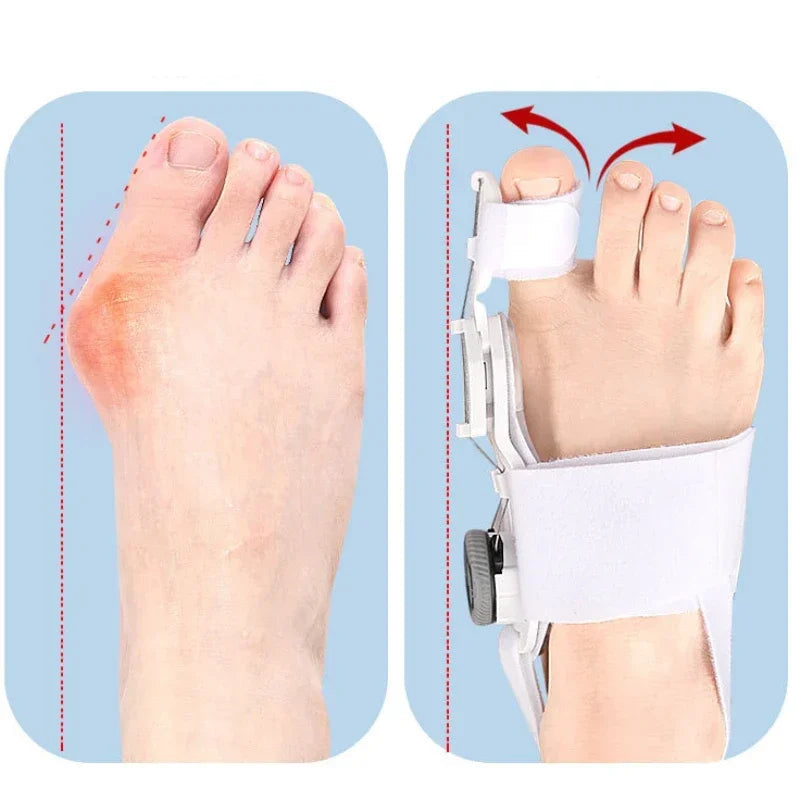 Correcteur Universel pour Hallux Valgus