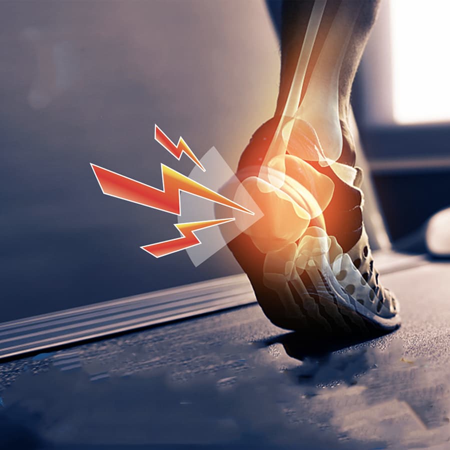 Crème antidouleur pour les pieds