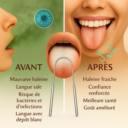 Nettoyeur de bouche en forme de u en acier inoxydable