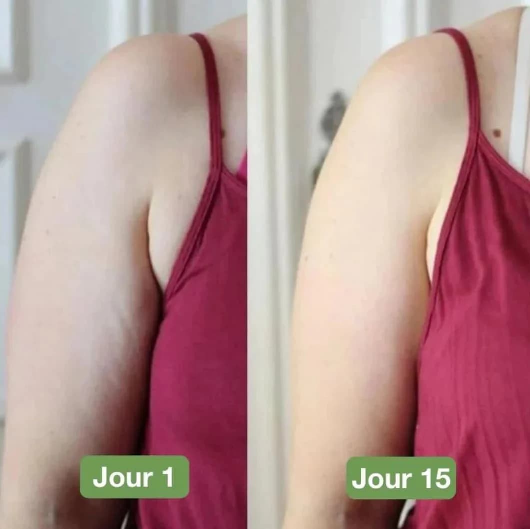 Appareil de massage anti-cellulite corporel