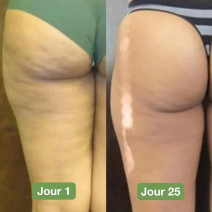 Appareil de massage anti-cellulite corporel