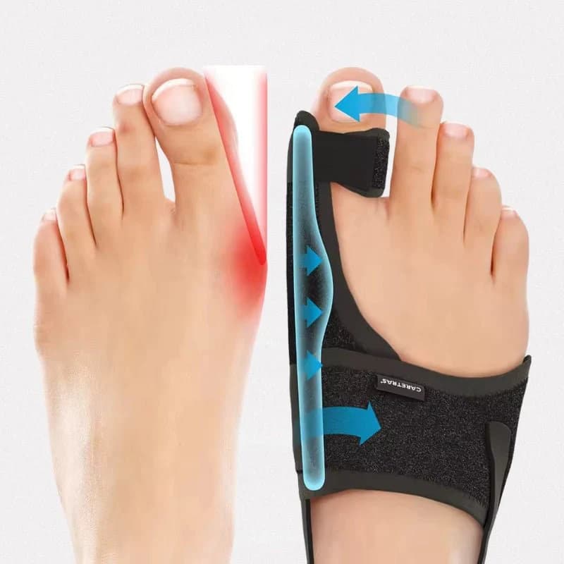 Attelle de nuit pour Hallux Valgus