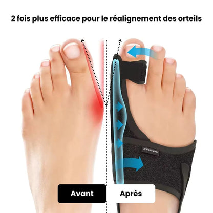 Attelle de nuit pour Hallux Valgus